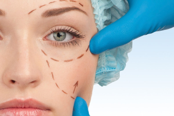 Blepharoplasty